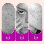 💝Buy 1 Get 1 Free🔥Flawless Brightening Under Eye Concealer